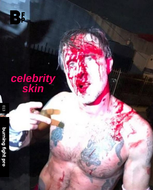 BFP 013: CELEBRITY SKIN